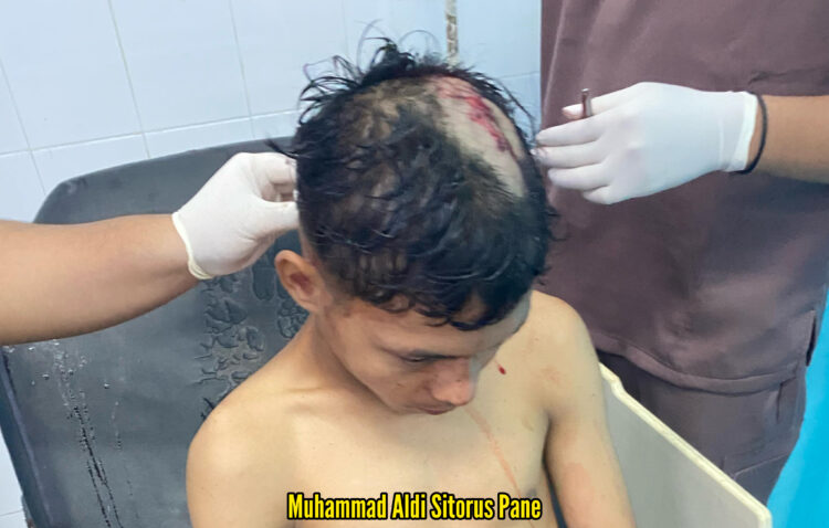 Atlet Tarung Derajat Asahan Diculik Dan Dianiaya Geng Motor