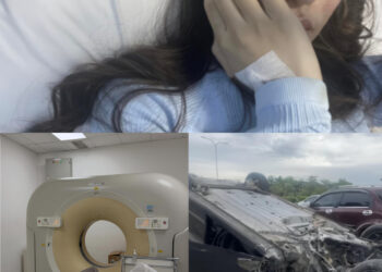 Mobilnya Hancur Kecelakaan di Jalan Tol, Model Cantik Diva Siregar Selamat