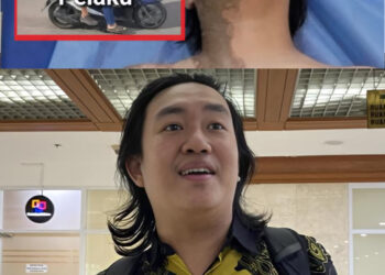 Inilah Kondisi Terkini Wakil KontraS yang Disiram Air Keras! Sekujur Tubuh Sebelah Kanan Alami Luka Bakar