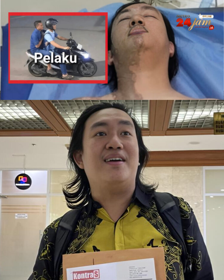 Inilah Kondisi Terkini Wakil KontraS yang Disiram Air Keras! Sekujur Tubuh Sebelah Kanan Alami Luka Bakar