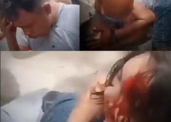 Meski Berlumuran Darah, Aksi Heroik Emak-emak Ini Berhasil Tangkap 2 Jambret